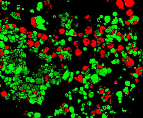 Workshop on Electrochemistry in Liquid TEM and on Orientation/Phase Mapping in Liquid